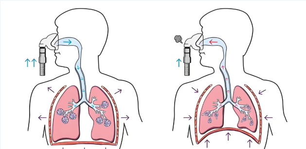 6天见效果！肺部疾病有了“精准靶向药”，肺结节、纤维化患者别错过